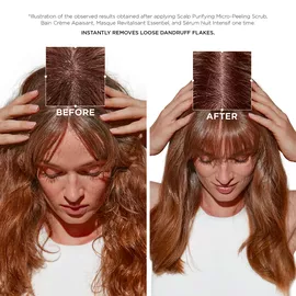 Scalp Purifying Micro-Peeling Scrub