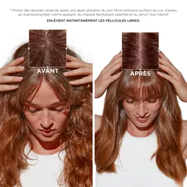 Symbiose Micro-Exfoliant Purifiant du Cuir Chevelu